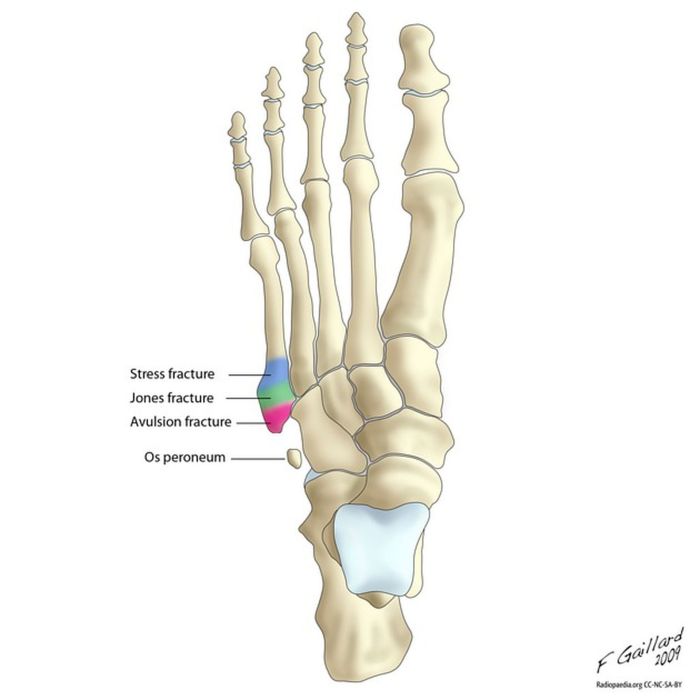 Styloid process of the foot