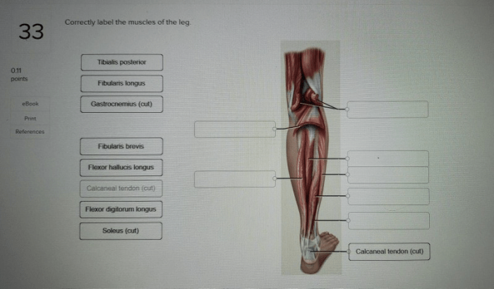 Correctly muscles leg label solved transcribed problem text been show has