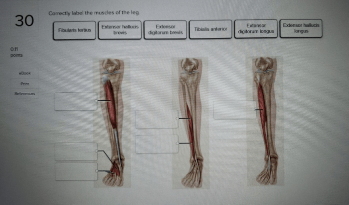 Correctly label the muscles of the leg.