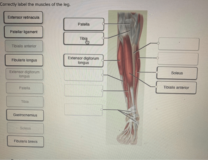 Correctly label the muscles of the leg.