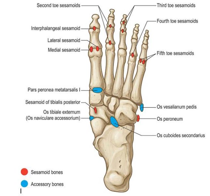 Styloid process fracture metatarsal foot base avulsion fractures 5th fifth stress subtle radiograph oblique demonstrates fig fatigue forefoot mid arrow